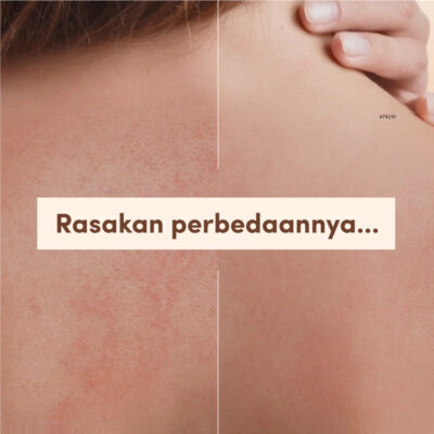 AVEENO Dermexa Daily Emollient Cream 200g-Lotion Pelembap untuk Kulit Sensitif, Kering & Rawan Eksim thumbnail 7
