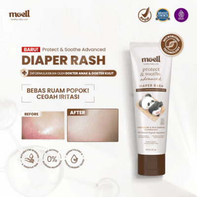 Moell Diaper Rash Advanced 50gr - Krim Popok Redakan & Cegah Ruam Popok - Bebas Ruam Nyaman Seharian thumbnail 2