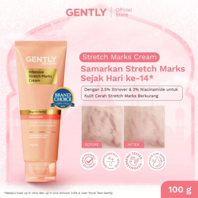 GENTLY Mamacare Intensive Stretch Marks Cream | Complex Hydrating Formula 5X Natural Soothing Agent thumbnail 2