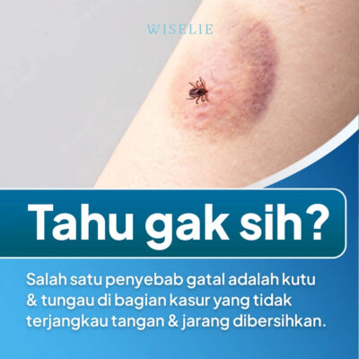 Wiselie Linen Spray Semprotan Linen Organik 250ML - dengan Formula Anti Bacterial thumbnail 2