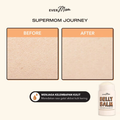 Evermom Natural Belly Balm Hands Free Mess Free-Krim Cegah Stretch Mark &Melembapkan Perut Ibu Hamil thumbnail 7